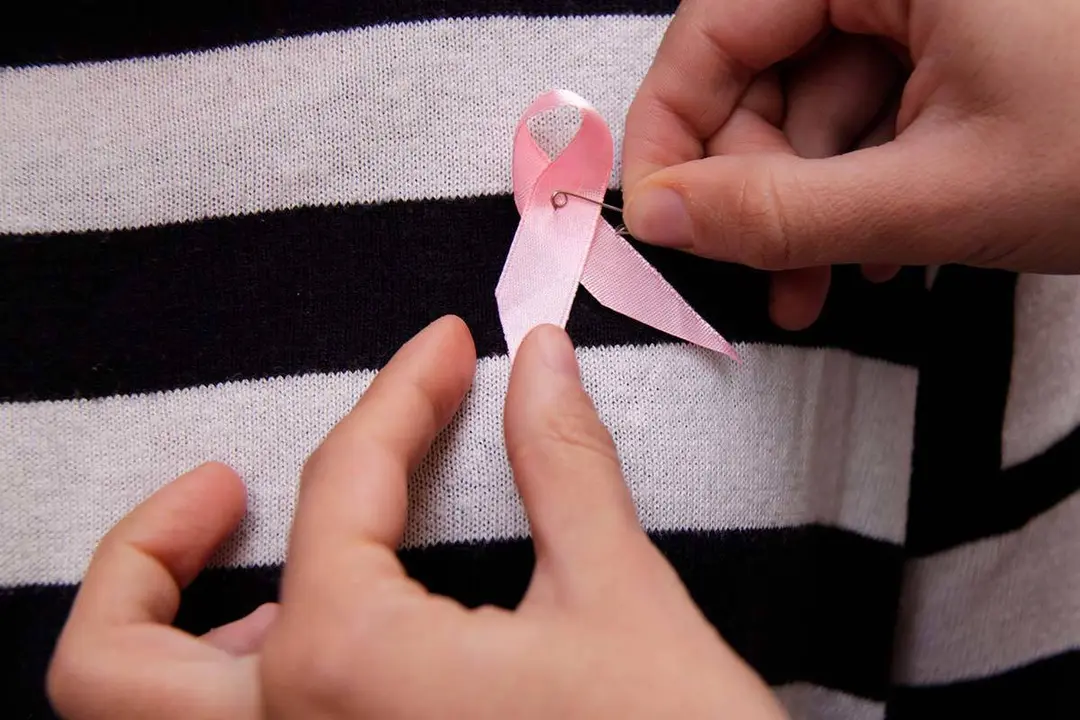 Se solicita limitar hasta diez a&ntilde;os la petici&oacute;n de informaci&oacute;n m&eacute;dica sobre patolog&iacute;as cancerosas para c&aacute;ncer adulto
