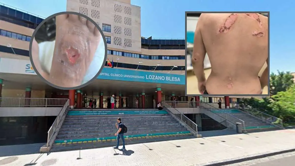 Las im&aacute;genes de la v&iacute;ctima, atendida en el Hospital Cl&iacute;nico de Zaragoza, acreditan la violencia continuada mientras estuvo encerrada en Garrapinillos.
