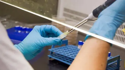 Esta patolog&iacute;a es una enfermedad de la piel causada por el &aacute;caro par&aacute;sito arador de la sarna
