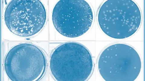 Imagen del efecto inhibidor de la infecci&oacute;n por SARS-CoV-2. Foto: CSIC