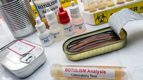 qu&eacute; es el botulismo