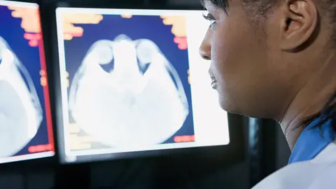 m&eacute;dico mira un esc&aacute;ner de cerebro