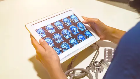 Cerebro humano analizado por sc&aacute;ner y visto en una tablet