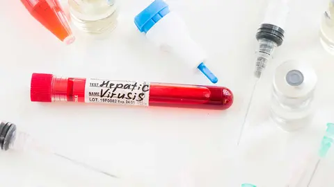 Tubo con muestra de hepatitis C
