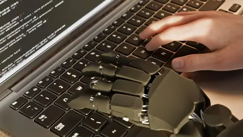 Una de las grandes innovaciones de Lirio Bionics y que lo diferencian del resto de la competencia est&aacute; en el modelo de negocio basado en el alquiler de estas piezas. Foto: YouTube de Lirio Bionics