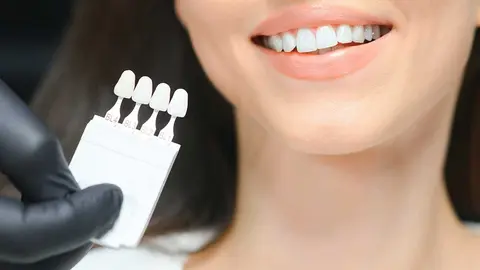dientes-blancos
