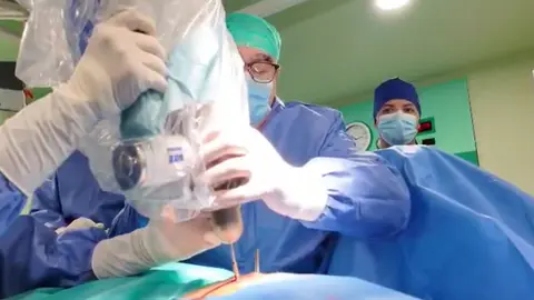 Un momento de la intervenci&oacute;n realizada en el Hospital Cl&iacute;nico Lozano Blesa de Zaragoza. Gobierno de Arag&oacute;n